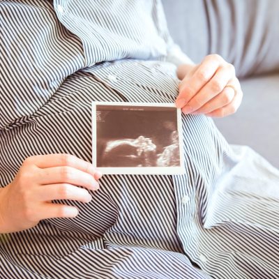 Close up of a pregnant belly with ultrasound photo